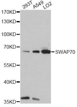 Polyclonal Rabbit anti-Human SWAP70 Antibody (WB)