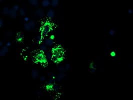 CAMLG / CAML Antibody (clone OTI1H3)