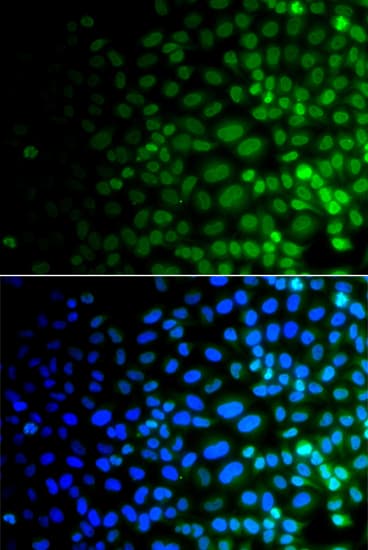 ULK4 Antibody
