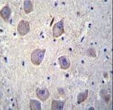Polyclonal Rabbit anti-Human ARRB1 / Beta Arrestin 1 Antibody (aa336-363, IHC, IF, WB)