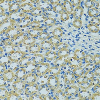 Polyclonal Rabbit anti-Human HSPB1 / HSP27 Antibody (IHC, IF, WB)
