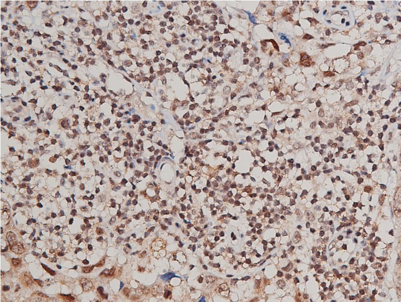 Polyclonal Rabbit anti-Human FLT1 / VEGFR1 Antibody (phospho-Tyr1213, IF, WB)