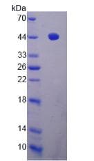 Human ADAMTS19 Protein (Recombinant His, N-Terminal)