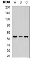 NTSR1 / NTR Antibody (Internal)