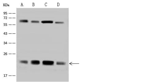ATP5H Antibody