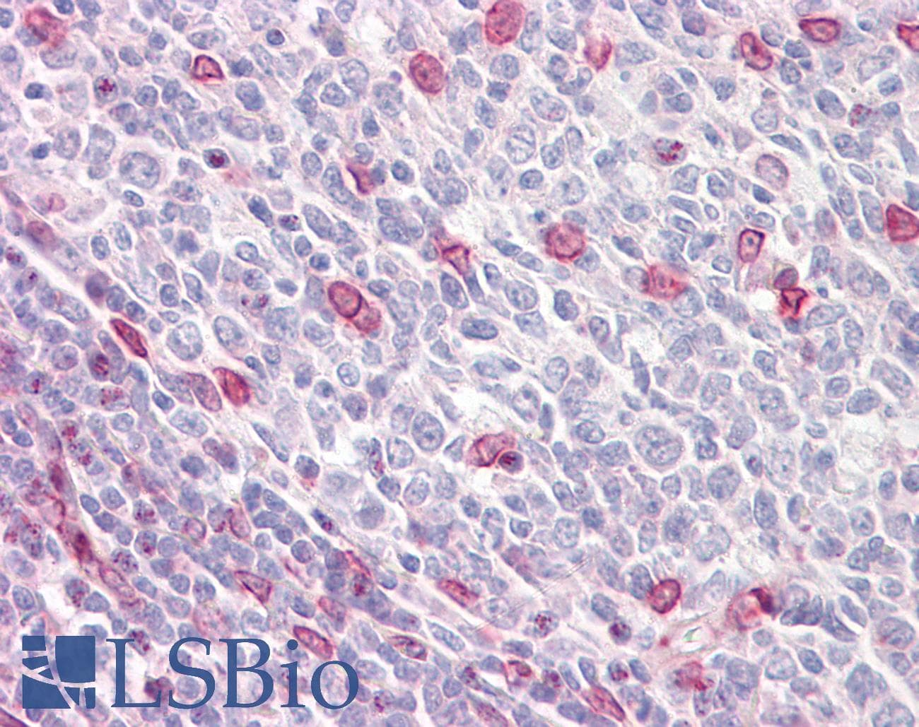 IHC-plus™ Polyclonal Rabbit anti-Human LMNA / Lamin A+C Antibody (aa212-261, IHC, WB)