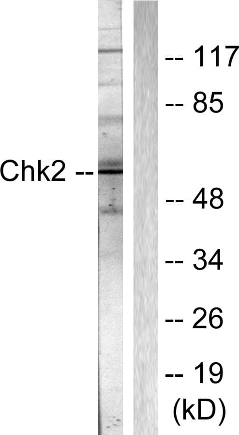 Polyclonal Rabbit anti-Human CHEK2 / CHK2 Antibody (aa361-410, IHC, WB)