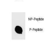 Polyclonal Rabbit anti-Human IKBKB / IKK2 / IKK Beta Antibody (phospho-Ser670)