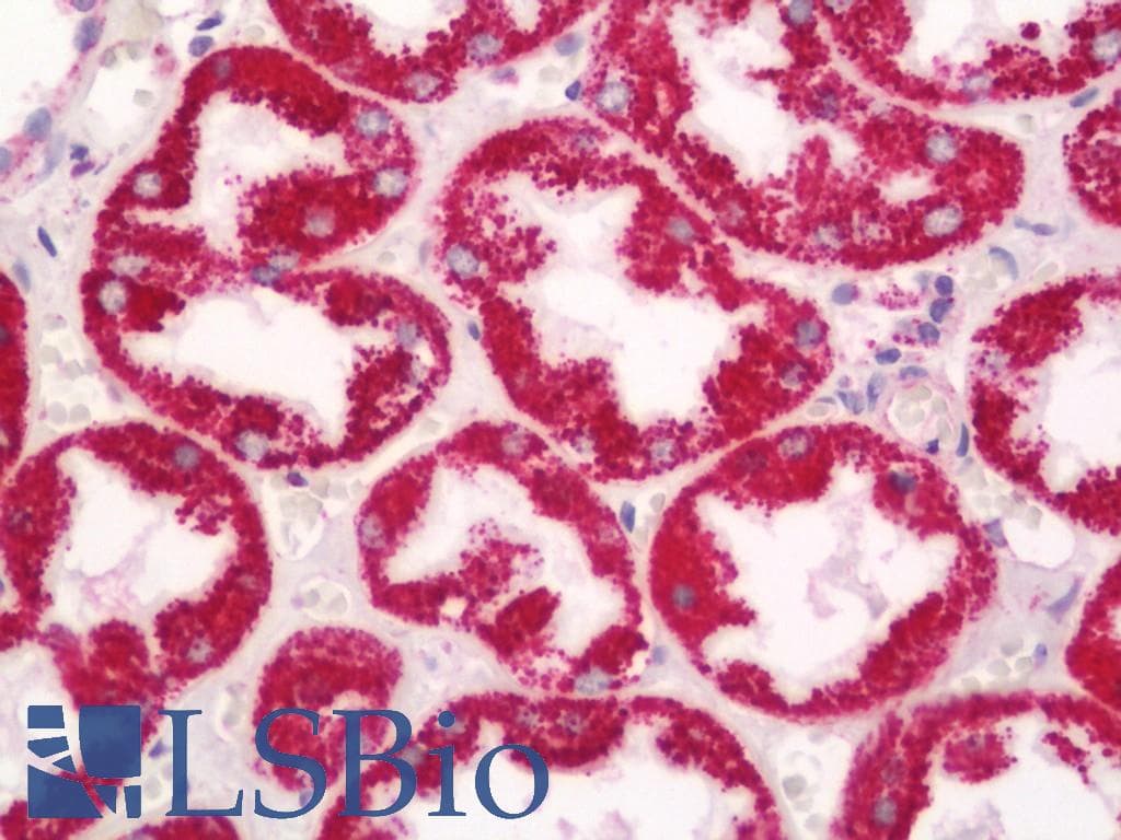 IHC-plus™ PCCA Antibody (aa678-728)
