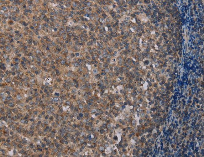 MMP20 Antibody