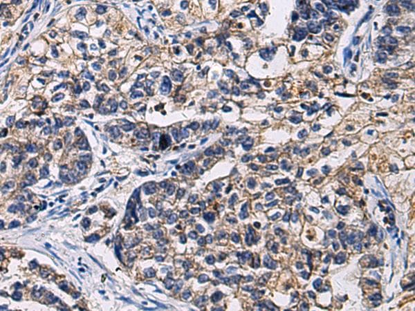 Polyclonal Rabbit anti-Human SSH3 Antibody (IHC)