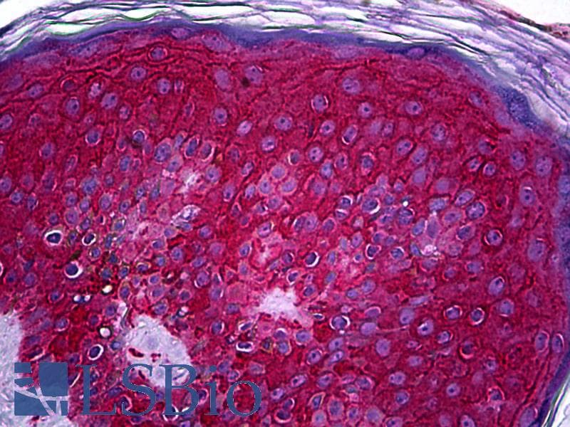 IHC-plus™ Monoclonal Mouse anti-Human c-Kit / CD117 Antibody (clone 6G12, IHC, WB)