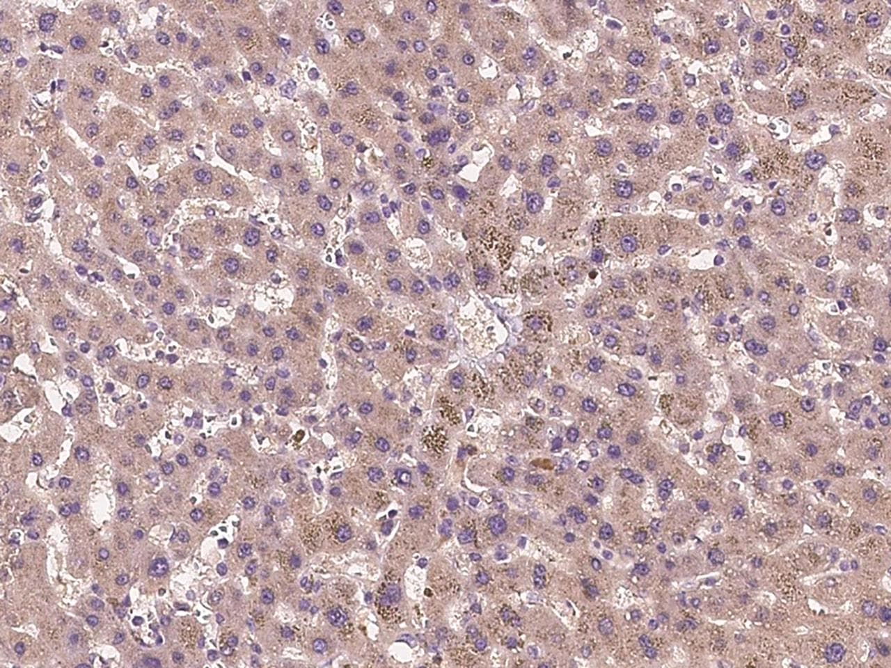 Polyclonal Rabbit anti-Human TUB / Tubby Antibody (IHC)