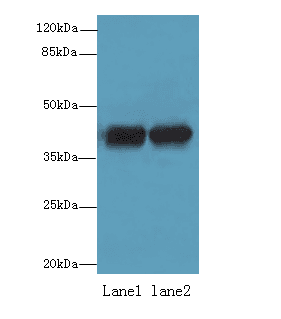 ACTRT2 Antibody