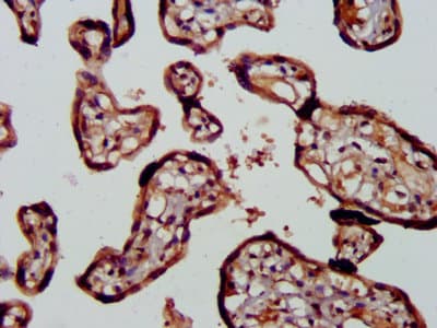 Polyclonal Rabbit anti-Human RICK / RIP2 Antibody (WB)