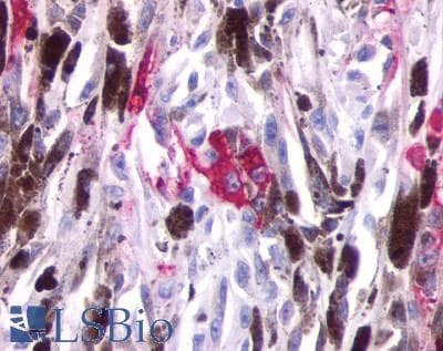 PathPlus™ Polyclonal Rabbit anti-Human OPN5 / Neuropsin Antibody (Transmembrane Domain, IHC)