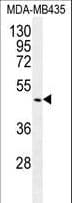 Polyclonal Rabbit anti-Human GDF5 / GDF-5 Antibody (aa343-371, IHC, WB)