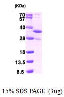 Human DDIT4 / REDD1 Protein (Recombinant His)