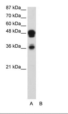 Polyclonal Rabbit anti-Human FOXA1 Antibody (aa395-444, IHC, WB)