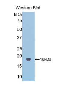 TLR3 Antibody (aa574-713)