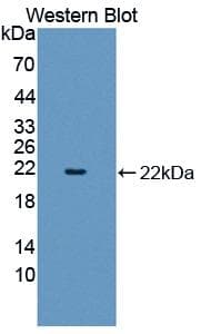 SHBG Antibody (aa51-218)