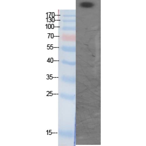 CREBBP / CREB Binding Protein Antibody (1480-1550 aa)