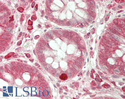 IHC-plus™ Polyclonal Rabbit anti-Human CDC34 Antibody (IHC, IF, WB)