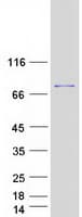 Human RECQ1 / RECQL Protein (Recombinant Myc-DDK (Flag))