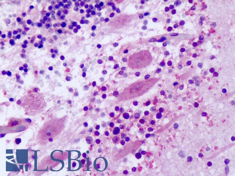 IHC-plus™ Polyclonal Rabbit anti-Human FZD8 / Frizzled 8 Antibody (Extracellular Domain, IHC)