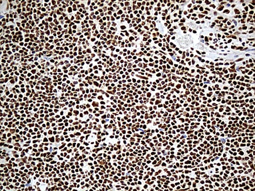 Monoclonal Mouse anti-Human DDX39B / UAP56 Antibody (clone OTI7H4, Carrier-free, aa319-428, IHC, WB)