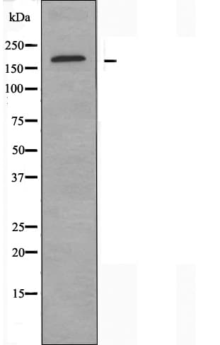 ABCC2 / MRP2 Antibody