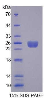 Rat ARHGEF7 Protein (Recombinant His-T7)