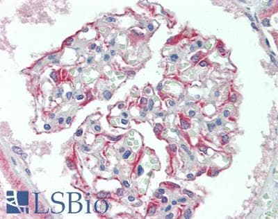 IHC-plus™ BBS4 Antibody (aa350-519)