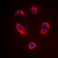 MMP10 Antibody (C-Terminus)