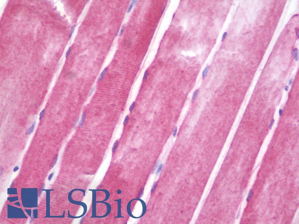 IHC-plus™ CRYAB / Alpha B Crystallin Antibody (aa84-112)