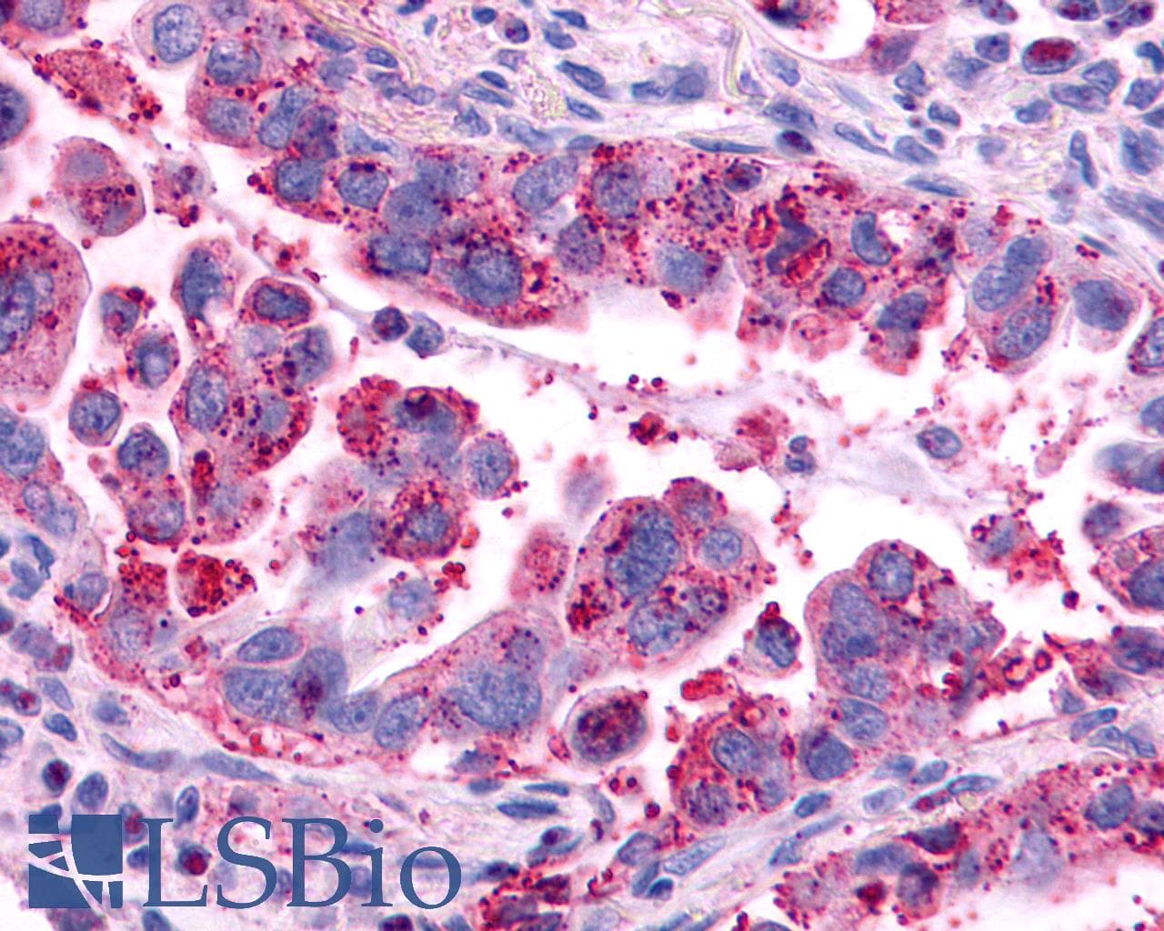 PathPlus™ AVPR2 / V2R Antibody (C-Terminus)