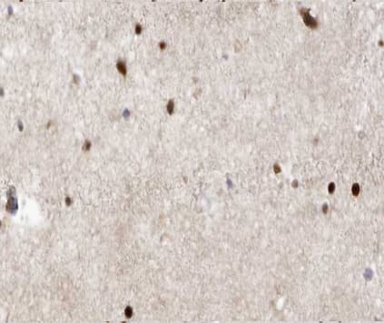 GAD1 / GAD67 Antibody
