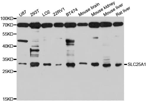 Polyclonal Rabbit anti-Human SLC25A1 / SEA Antibody (IHC, WB)
