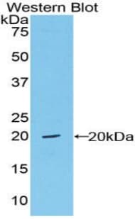 VWF / Von Willebrand Factor Antibody (aa1498-1665)