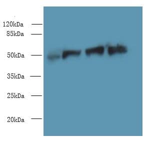 Polyclonal Rabbit anti-Human FDXR Antibody (IHC, WB)