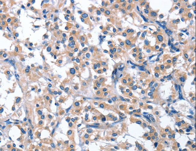 ASB2 Antibody