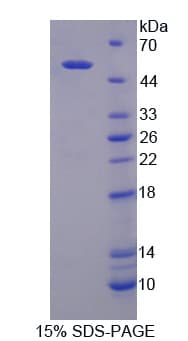 Human DPP2 / DPP7 Protein (Recombinant His-T7)