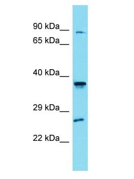 Polyclonal Rabbit anti-Human SLC35G4 Antibody (aa4-53, WB)