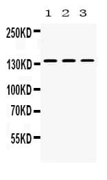 NPHS1 / Nephrin Antibody