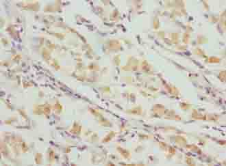 VWA9 / C15orf44 Antibody