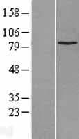 SUZ12 Protein (Over-Expression Lysate Myc-DDK (Flag))