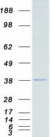Human NEK7 Protein (Recombinant Myc-DDK (Flag))