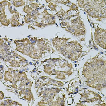 FDX1 / ADX Antibody