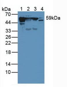 KRT10 / CK10 / Cytokeratin 10 Antibody (aa153-456, Cy3)