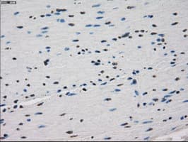 FCGR2 / CD32 Antibody (clone OTI16D6)